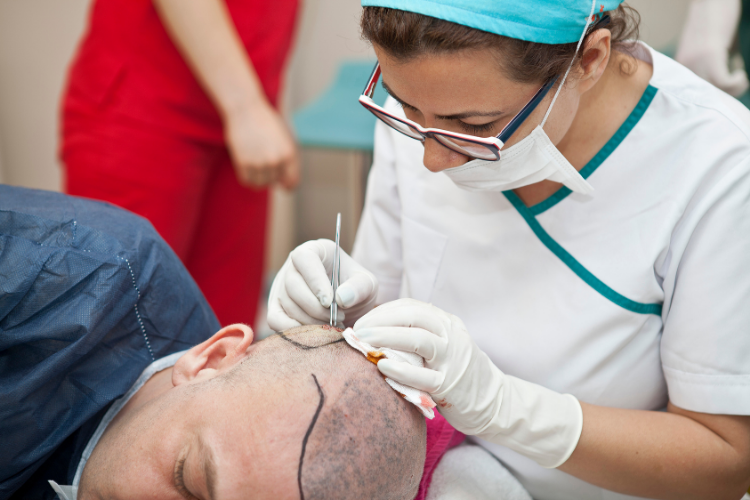 Hair Transplant in Istanbul